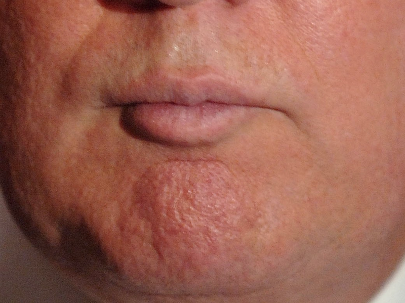 Illustration for article titled A Visual History of Donald Trump's Mouth